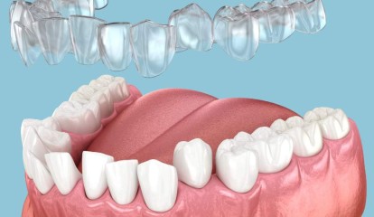 Novas Tecnologias no Diagnóstico e Tratamento Ortodôntico