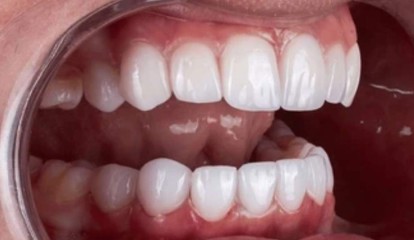 Periodontia e implantes dentários
