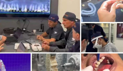 Univali devolve sorriso a paciente em poucas horas com tecnologia odontológica inovadora