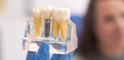 Prótese Fixa sobre Dentes e sobre Implantes