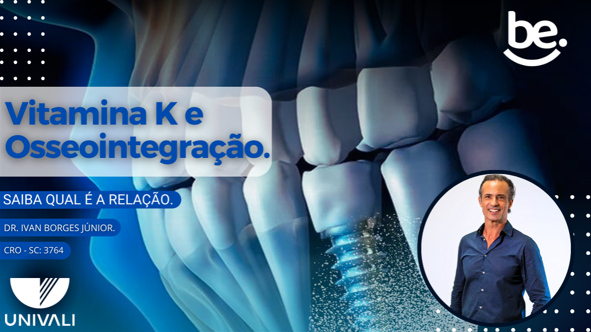Qual a relação entre Vitamina K e Osseointegração?